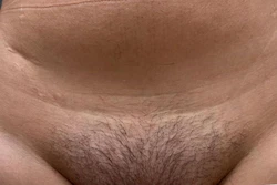 Outstanding results after only 6 sessions safely performed in the comfort of your own home or workplace